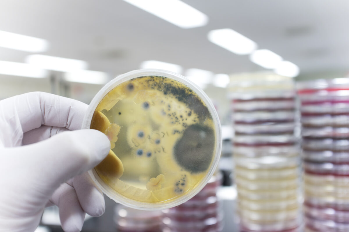 A hand with a medical glove is holding a agar plate with a culture of pathogenic fungi.