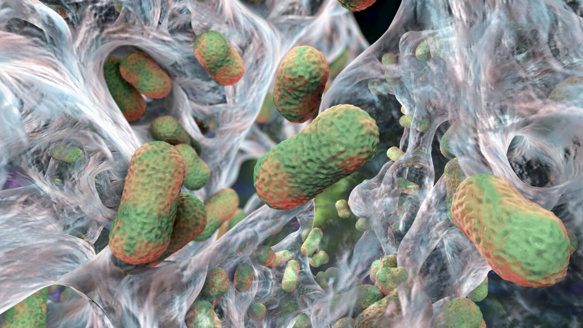 Multi-drug resistant Acinetobacter baumannii bacteria inside biofilm, computer illustration. A. baumannii is a Gram-negative, oxidase negative, aerobic, coccobacillus. It has always been naturally resistant to multiple antibiotics. It can be especially resistant to penicillin and chloramphenicol. It causes various nosocomial infections, including, skin and wound infections, pneumonia, meningitis, septicaemia, urinary tract infection and endocarditis. It is commonly found in soil, water, sewage, and normal skin and gastrointestinal tract flora. It is the most frequently encountered species in the clinical laboratory. Species found in soil can colonize root nodule systems and oxidize the hydrogen produced by nitrogen fixing bacteria. The illustration shows morphology of Acinetobacter such as short rods and sometimes long filamentous cells.